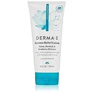 Derma E - Eczema Relief Lotion ? Itchy Skin Rescue Cream ? Soothing Eczema Cream Relieves Flaky, Scaly and Dry Skin - Topical Eczema and Psoriasis Cream, 6 Fl Oz